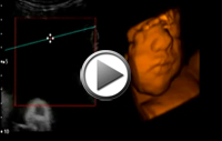 Video3