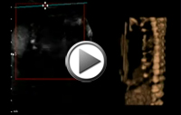 Video4